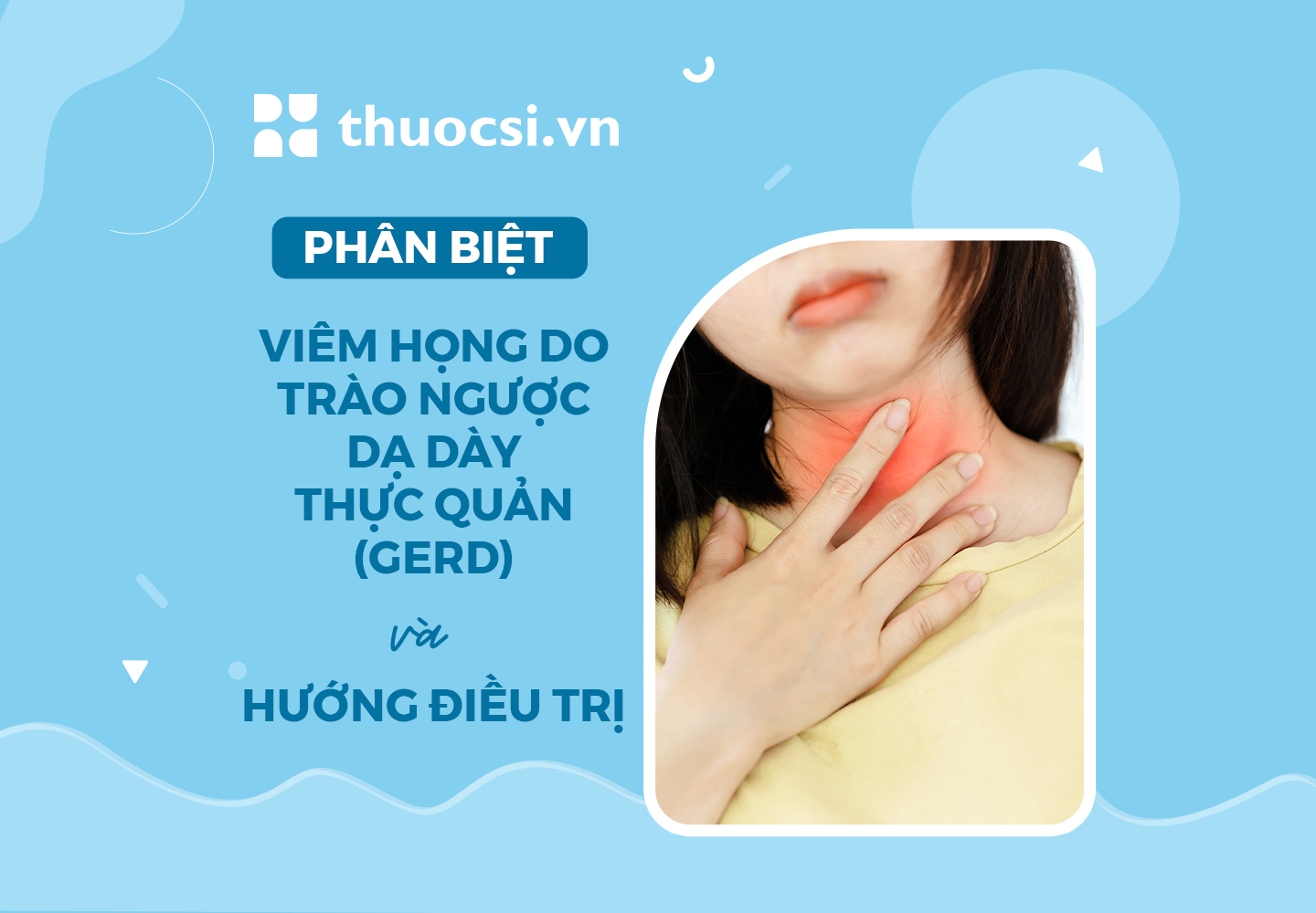 Viêm họng do trào ngược dạ dày thực quản (GERD) và hướng điều trị